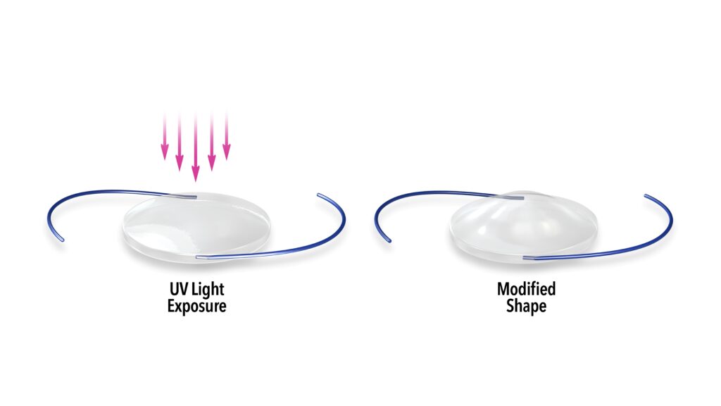 Light Adjustable Lens diagram