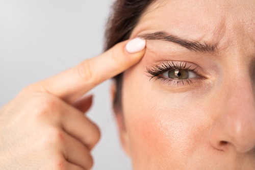 Eyelid surgery clearance fort myers